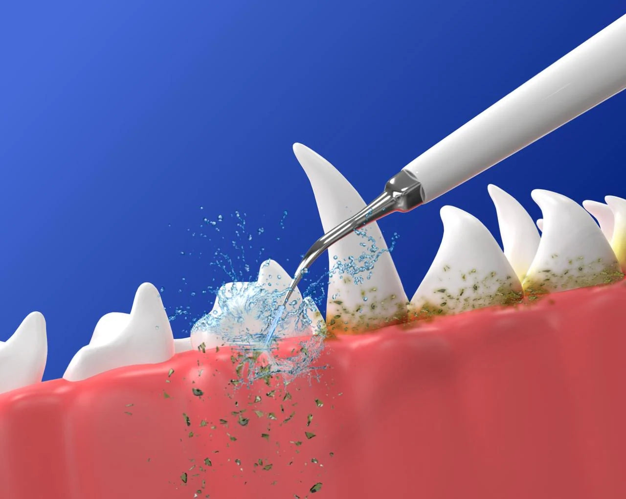 סט 3 ראשי ניקוי דנטלים להורדת פלאק - PawLabs™